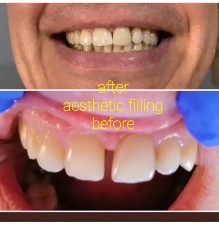 Alanya HEALTHY TEETH Dental Aesthetic — Medicina em Alanya: Encomenda online, preços e comentários